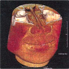 CTスキャナー画像イメージ